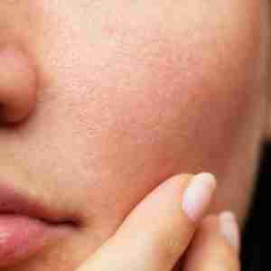 Skin microbiome - maintain healthy bacteria